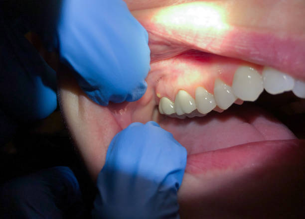 Best Orthodontic Emergency Dentist in Rushvle, IL